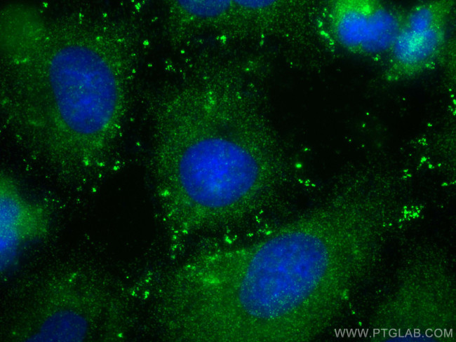 RFPL4B Antibody in Immunocytochemistry (ICC/IF)