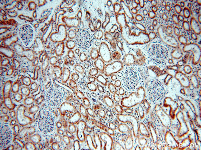 NARFL Antibody in Immunohistochemistry (Paraffin) (IHC (P))