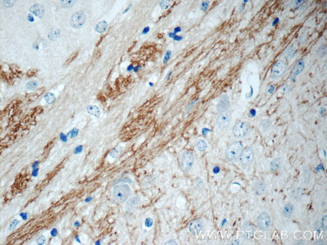 EPHA6 Antibody in Immunohistochemistry (Paraffin) (IHC (P))