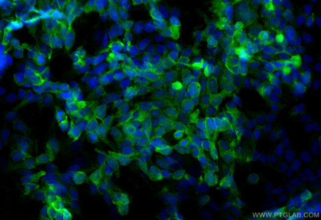 GPR150 Antibody in Immunocytochemistry (ICC/IF)