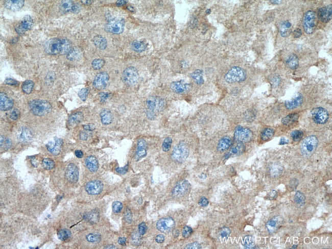 IGF1A Antibody in Immunohistochemistry (Paraffin) (IHC (P))