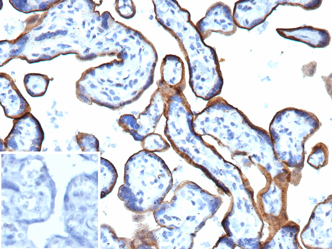 Endoglin/CD105 (Angiogenesis Marker) Antibody in Immunohistochemistry (Paraffin) (IHC (P))