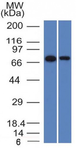 Endoglin/CD105 (Angiogenesis Marker) Antibody in Western Blot (WB)