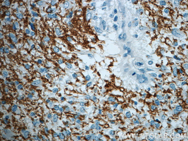 ROBO3 Antibody in Immunohistochemistry (Paraffin) (IHC (P))