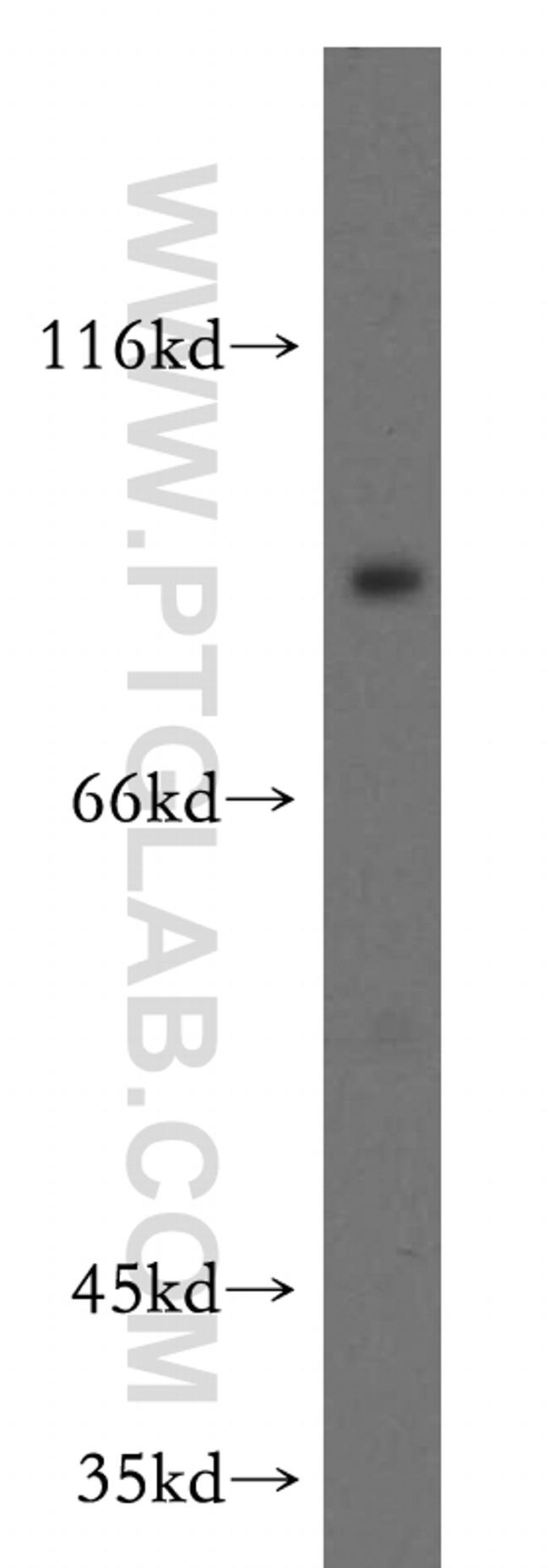DLL1 Antibody in Western Blot (WB)