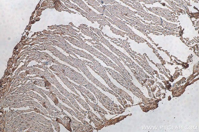 NTN1 Antibody in Immunohistochemistry (Paraffin) (IHC (P))
