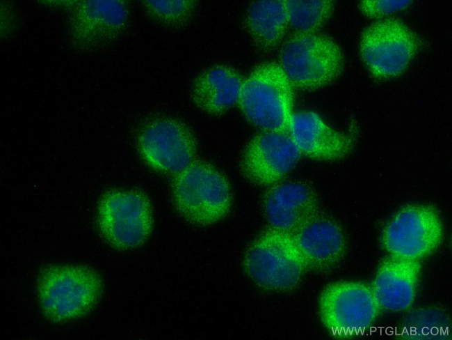DOCK2 Antibody in Immunocytochemistry (ICC/IF)