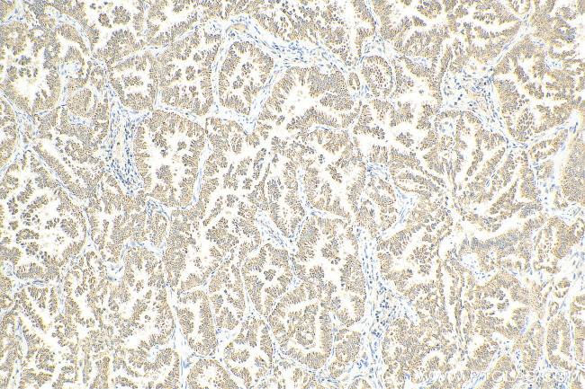 ROCK1 Antibody in Immunohistochemistry (Paraffin) (IHC (P))