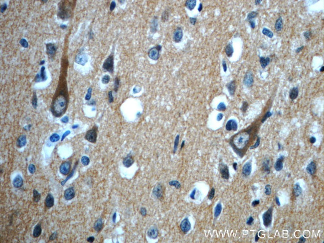 CPLX2 Antibody in Immunohistochemistry (Paraffin) (IHC (P))