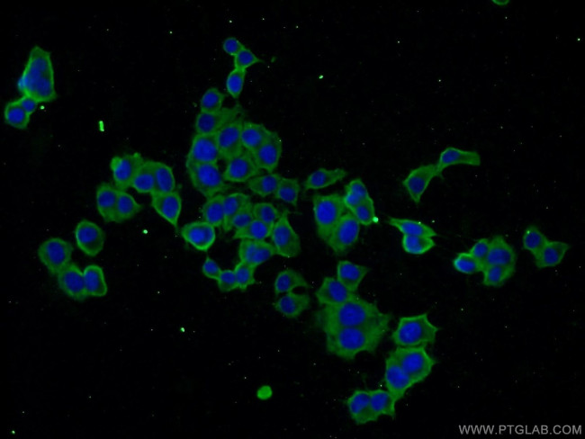 SCN9A/Nav1.7 Antibody in Immunocytochemistry (ICC/IF)