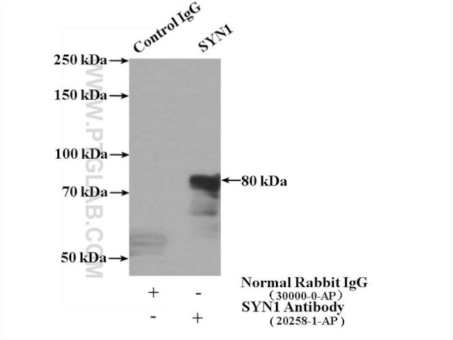 SYN1 Polyclonal Antibody | Invitrogen (20258-1-AP)