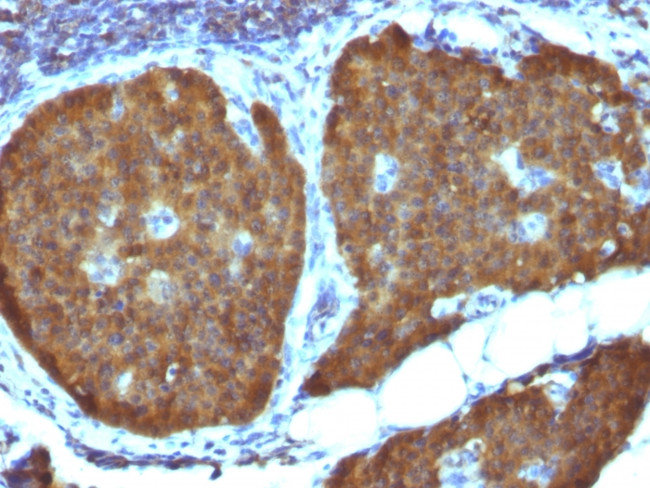 NSE gamma (Neuron Specific Enolase, gamma) (Neuroendocrine Marker) Antibody in Immunohistochemistry (Paraffin) (IHC (P))