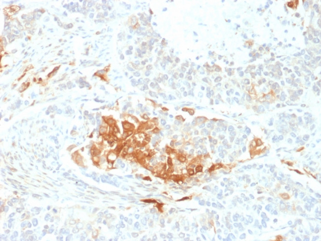 NSE gamma (Neuron Specific Enolase, gamma) Antibody in Immunohistochemistry (Paraffin) (IHC (P))