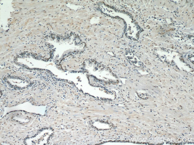 TAF1 Antibody in Immunohistochemistry (Paraffin) (IHC (P))