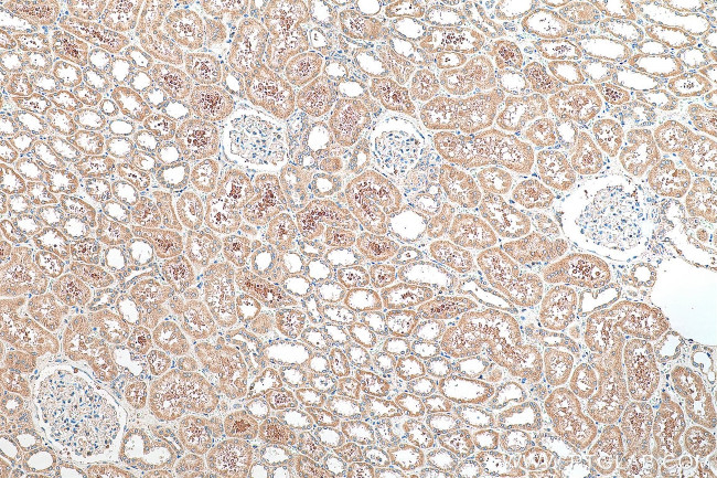 SERINC3 Antibody in Immunohistochemistry (Paraffin) (IHC (P))