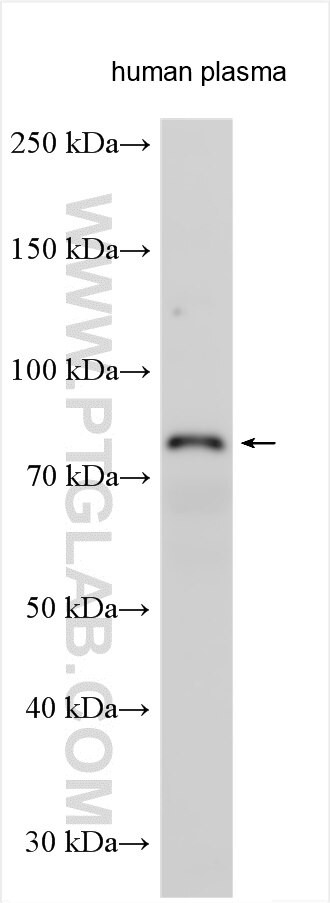 Factor XIIIb Antibody in Western Blot (WB)