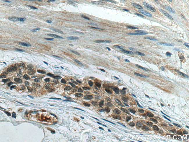 RREB1 Antibody in Immunohistochemistry (Paraffin) (IHC (P))