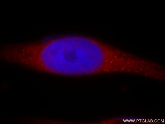 RADIL Antibody in Immunocytochemistry (ICC/IF)