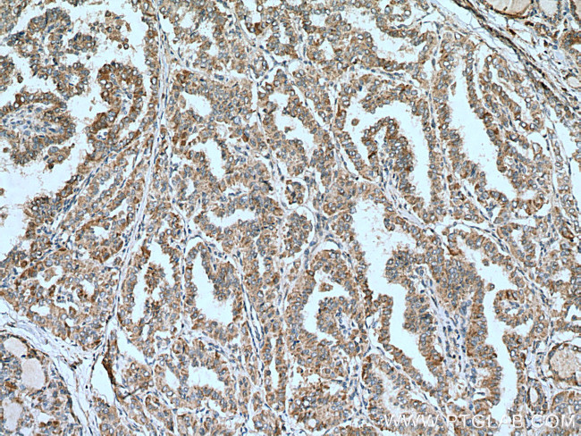 ALG3 Antibody in Immunohistochemistry (Paraffin) (IHC (P))