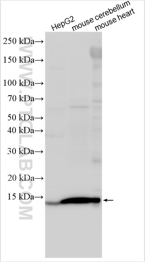 P2RY2 Antibody in Western Blot (WB)