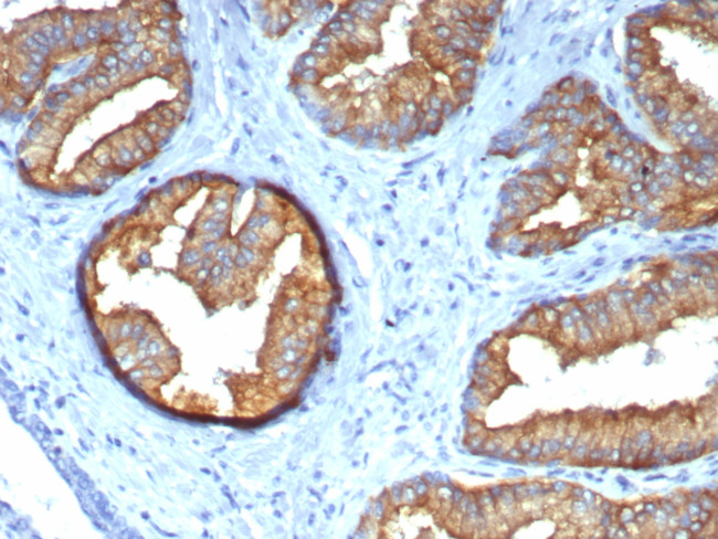Tubulin, beta Antibody in Immunohistochemistry (Paraffin) (IHC (P))