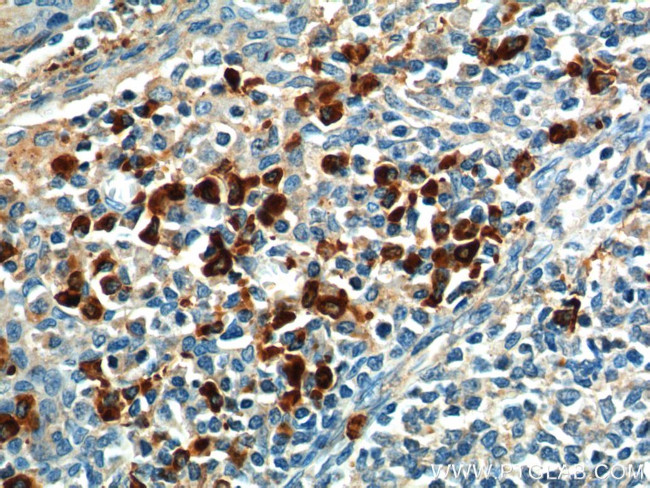 GPR171 Antibody in Immunohistochemistry (Paraffin) (IHC (P))