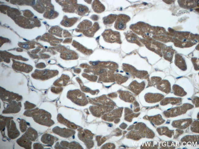 MEF2C Antibody in Immunohistochemistry (Paraffin) (IHC (P))
