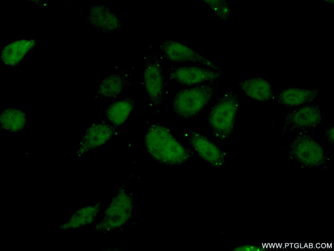 TIAF1 Antibody in Immunocytochemistry (ICC/IF)