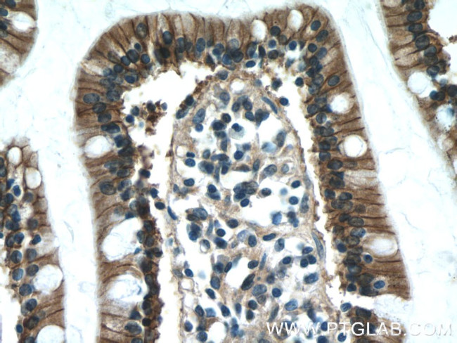 P2RY13 Antibody in Immunohistochemistry (Paraffin) (IHC (P))