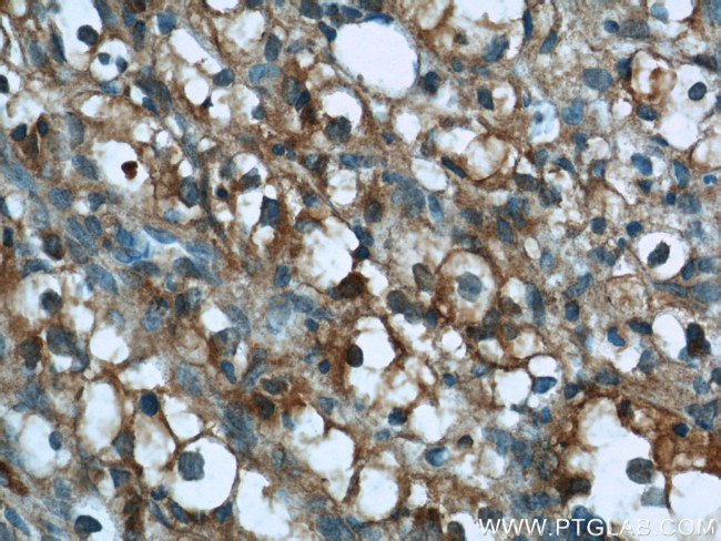GPNMB Antibody in Immunohistochemistry (Paraffin) (IHC (P))