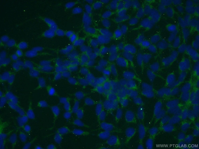 SMEK2 Antibody in Immunocytochemistry (ICC/IF)