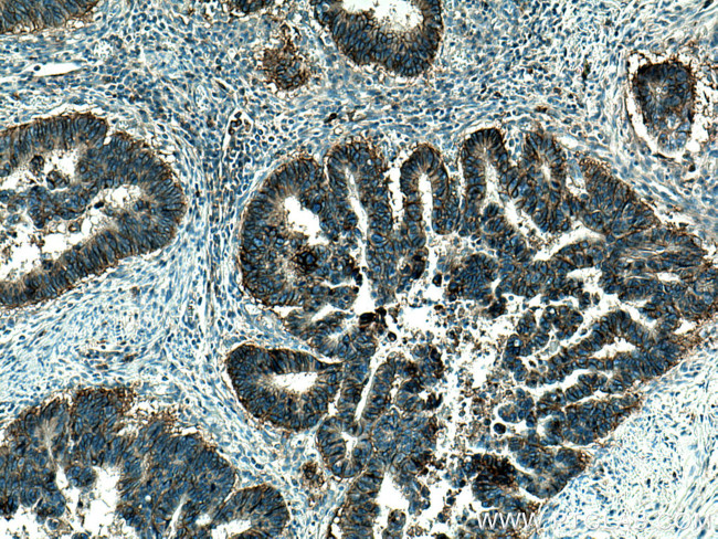 ASCT2 Antibody in Immunohistochemistry (Paraffin) (IHC (P))