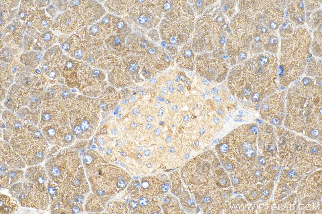 COPZ2 Antibody in Immunohistochemistry (Paraffin) (IHC (P))