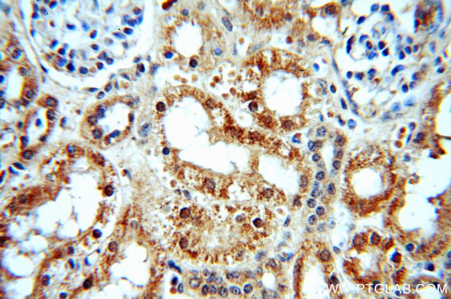 PKNOX2 Antibody in Immunohistochemistry (Paraffin) (IHC (P))