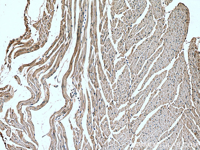 MCT2 Antibody in Immunohistochemistry (Paraffin) (IHC (P))