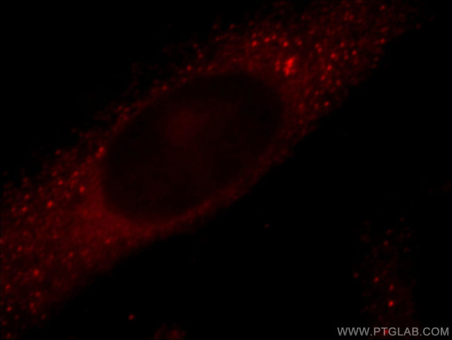 TRIM2 Antibody in Immunocytochemistry (ICC/IF)