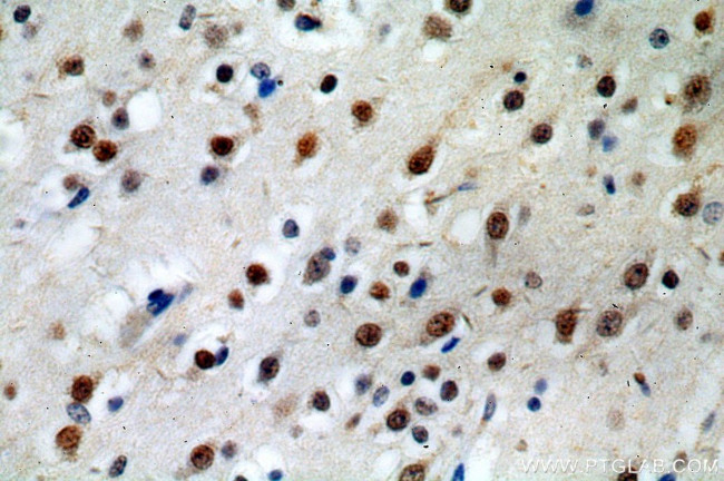 POLR2B Antibody in Immunohistochemistry (Paraffin) (IHC (P))