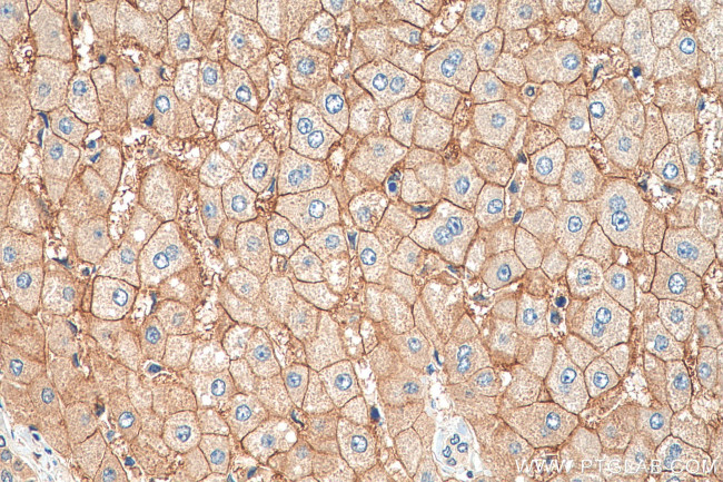 AQP9 Antibody in Immunohistochemistry (Paraffin) (IHC (P))