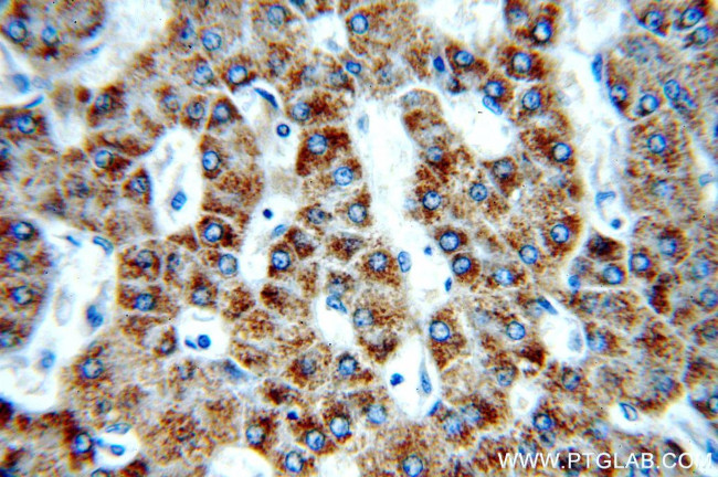 PECI Antibody in Immunohistochemistry (Paraffin) (IHC (P))