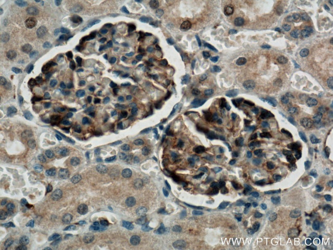 NPHS2 Antibody in Immunohistochemistry (Paraffin) (IHC (P))