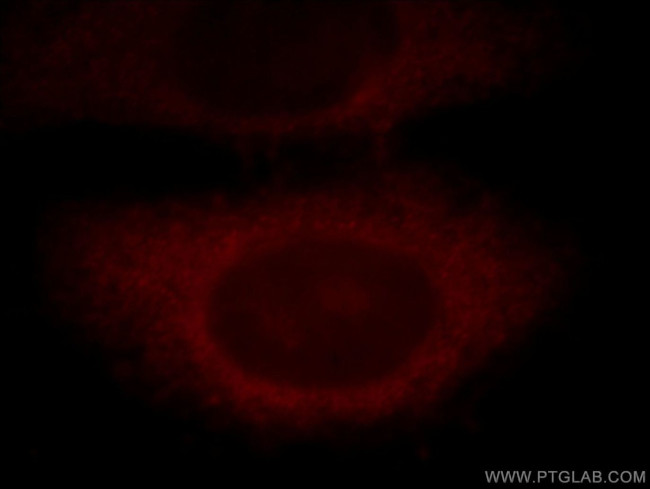 CLN3 Antibody in Immunocytochemistry (ICC/IF)