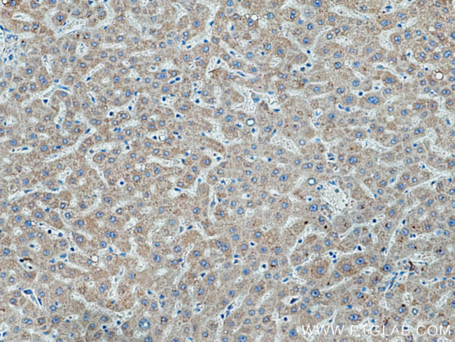 TMEM70 Antibody in Immunohistochemistry (Paraffin) (IHC (P))