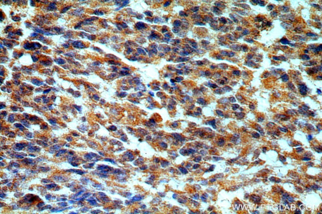 STAC3 Antibody in Immunohistochemistry (Paraffin) (IHC (P))