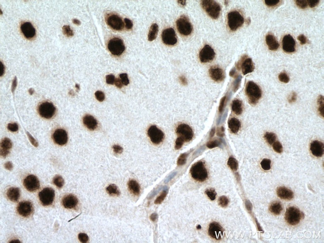 SNRPE Antibody in Immunohistochemistry (Paraffin) (IHC (P))