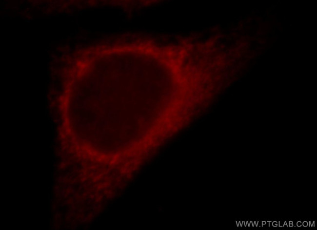 RNF181 Antibody in Immunocytochemistry (ICC/IF)