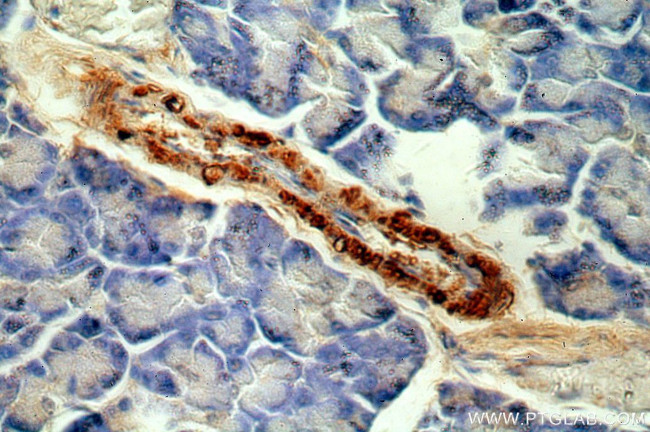 C11orf51 Antibody in Immunohistochemistry (Paraffin) (IHC (P))