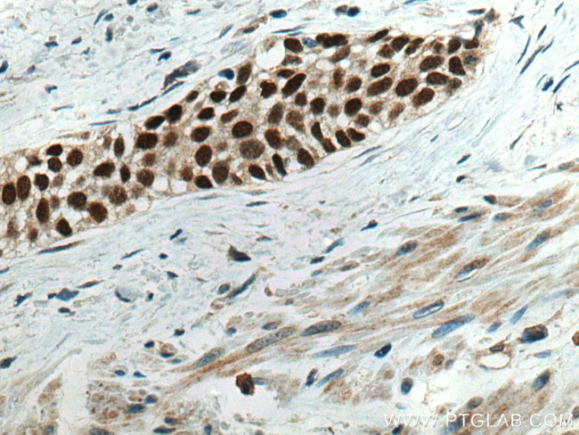 FOXA1 Antibody in Immunohistochemistry (Paraffin) (IHC (P))