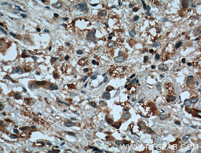 C10orf18 Antibody in Immunohistochemistry (Paraffin) (IHC (P))