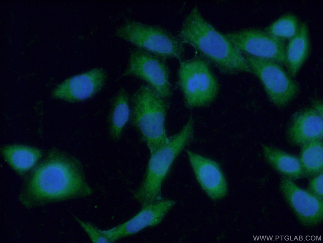 Fibulin-1 Antibody in Immunocytochemistry (ICC/IF)