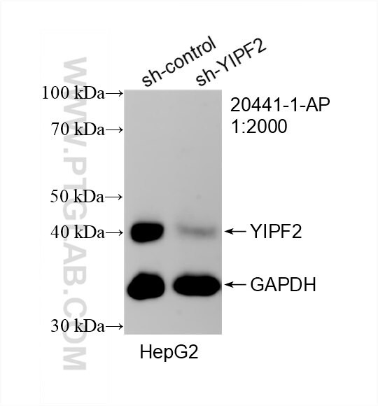 KBTBD4 Antibody in Western Blot (WB)